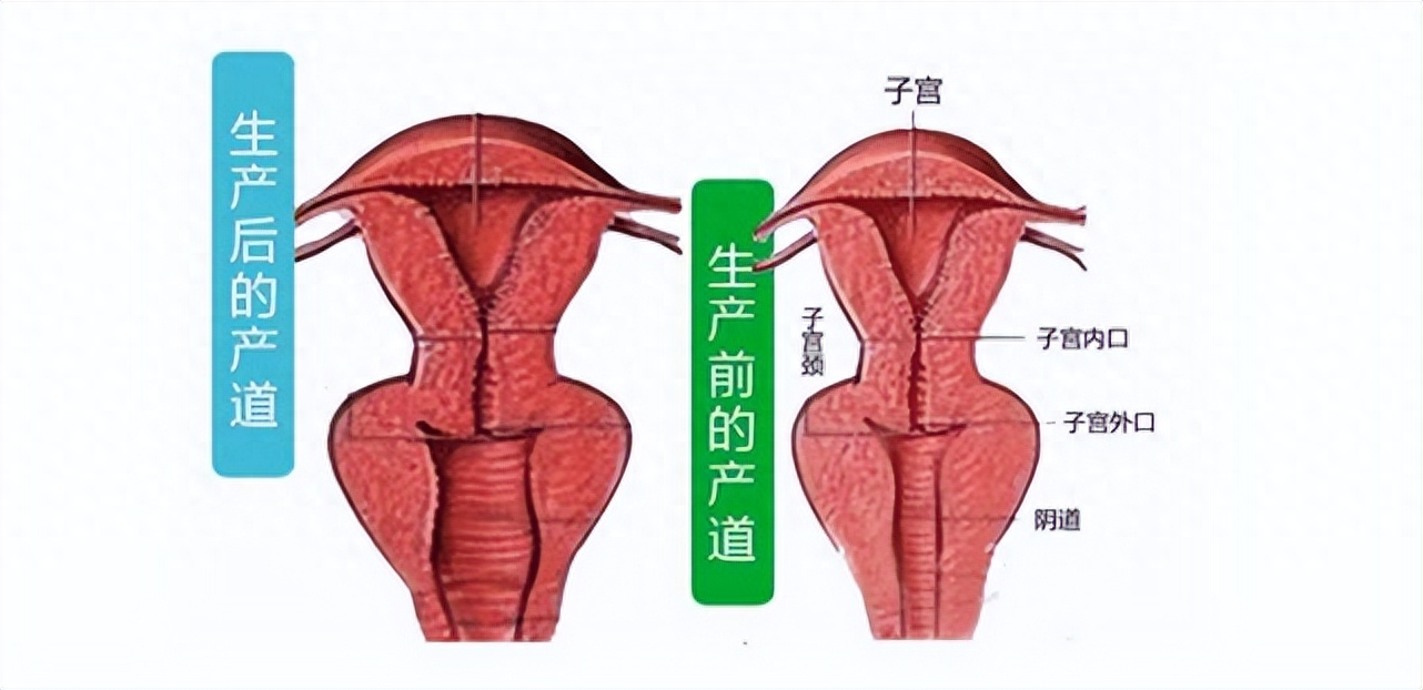 阴道松弛要怪性生活太多？这才是阴道松弛的真相(图10)