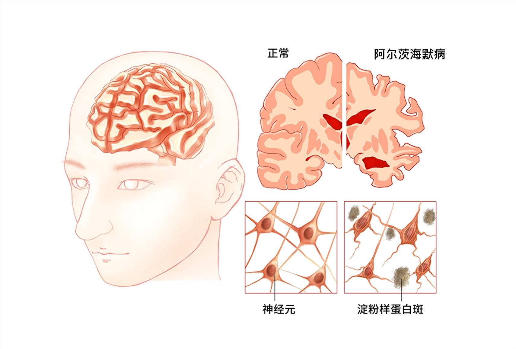 人死后细胞都在做啥？有的“叛变”自相残杀，有的拼命想复活主人(图15)