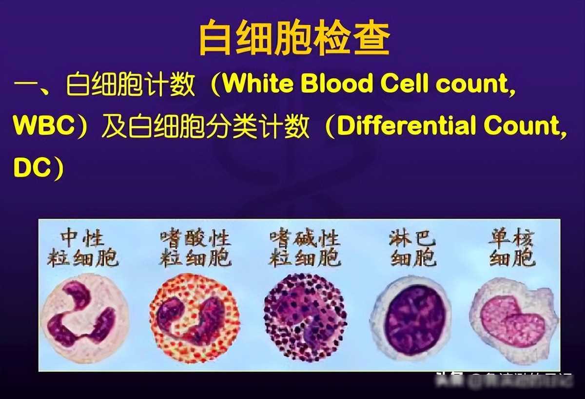 日本核辐射有多恐怖？工人被辐射，眼看着自己腐烂，83天堪比凌(图23)