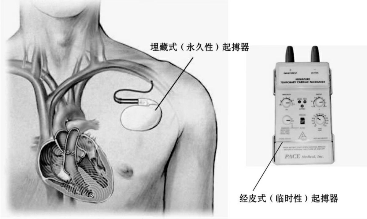 100多年来的重大突破！中国研发新型压电材料，再次遥遥领先？(图20)